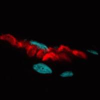 ALPHA-BUNGAROTOXIN CF594 100ug 00007-100ug