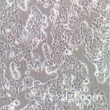 MCF-7+luc/人乳腺癌细胞+luc