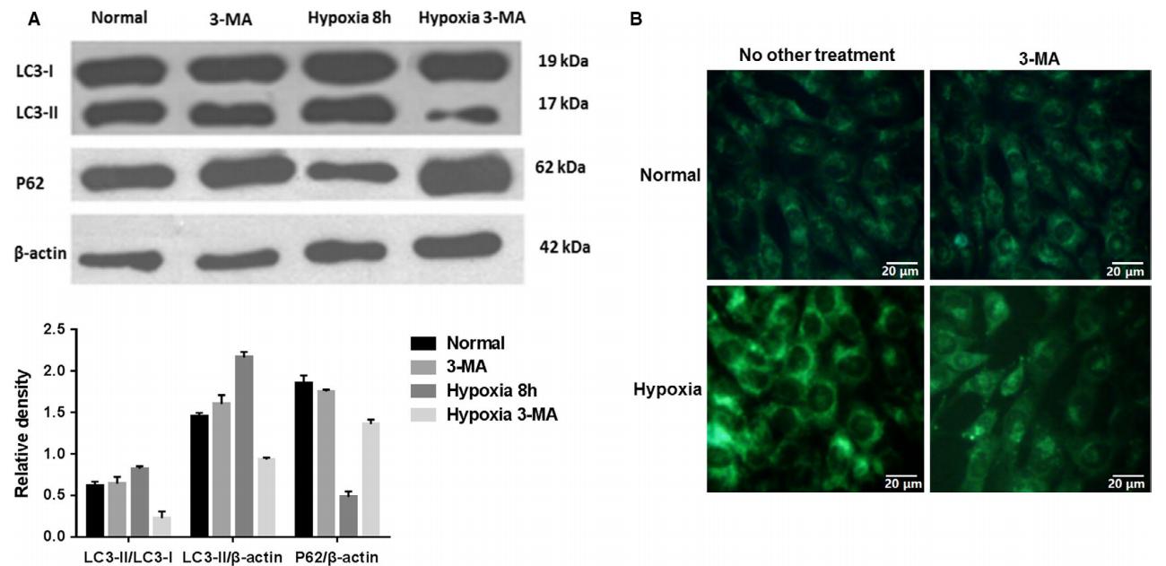 低氧/厌氧产品案例——骨髓间充质干细胞研究