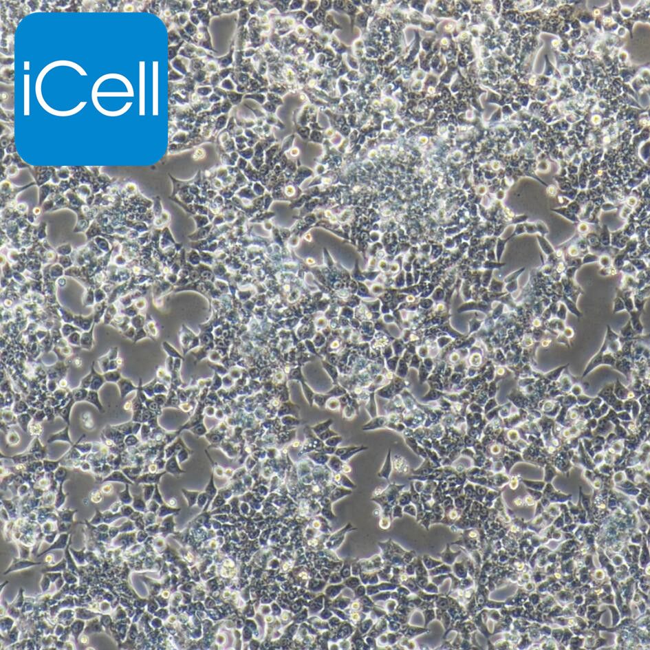 HCT116+luc 人结肠癌细胞 荧光素酶标记 赛百慷（iCell）
