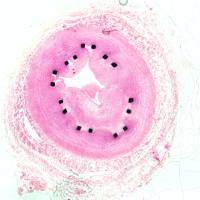 硬组织切片染色