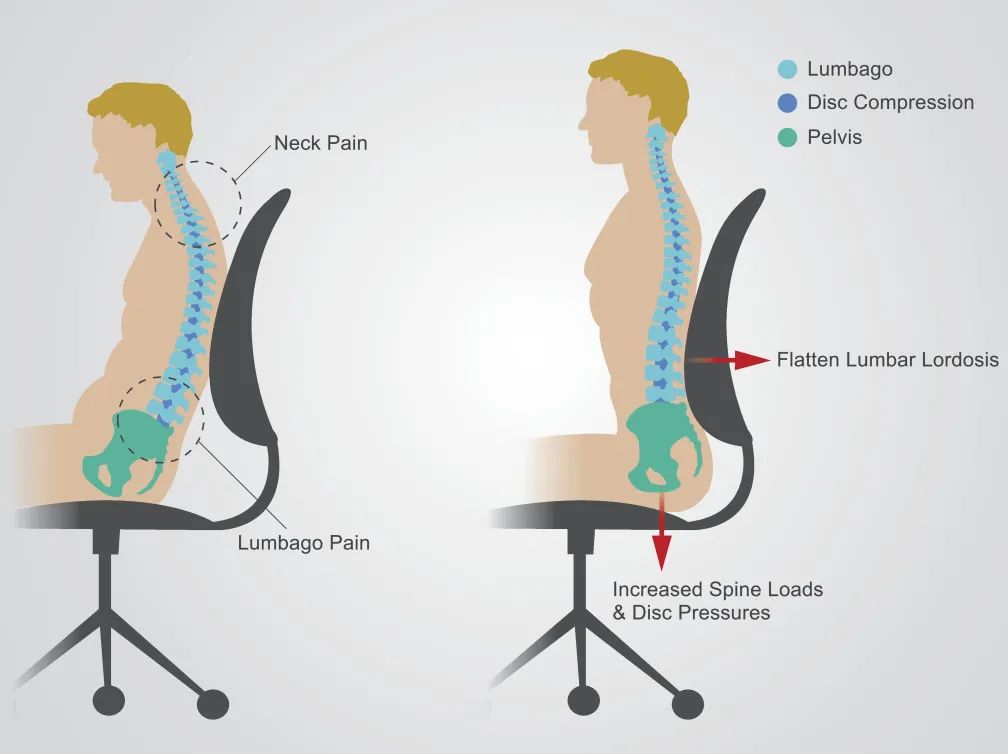 常年腰痛难忍久不愈,腰椎后路融合术让他重获健康