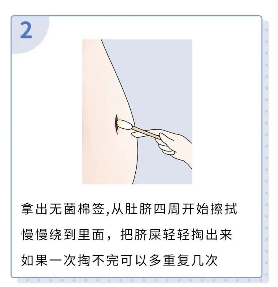 这个洞男女都不能乱抠，抠完要命！