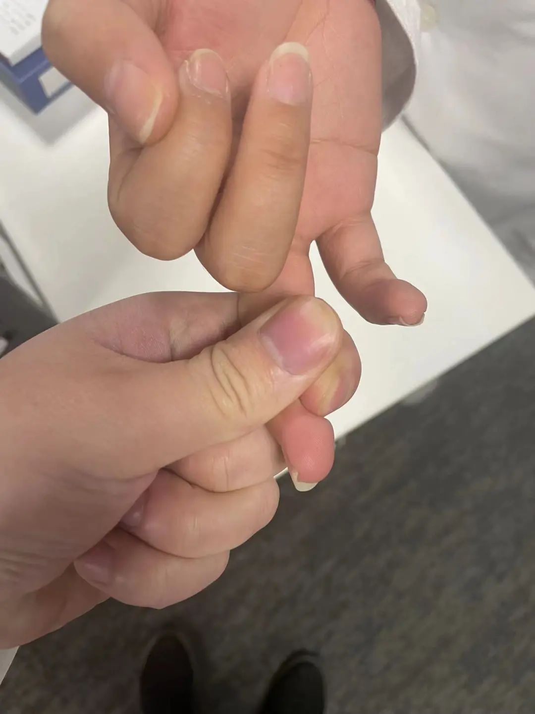 在家如何精确测量血糖，你了解么？