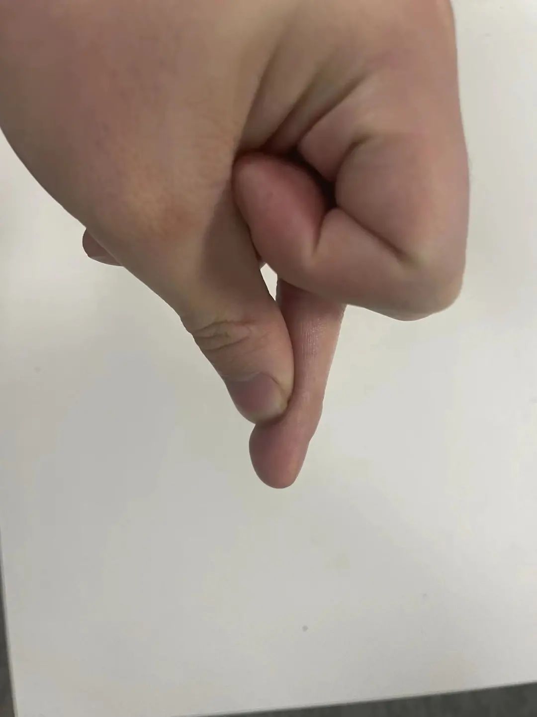 在家如何精确测量血糖，你了解么？