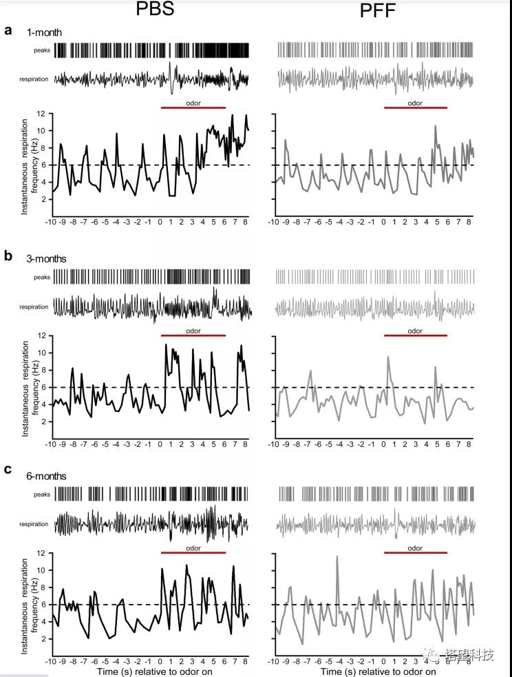 WBP全身体积描记系统在帕金森病研究中的应用
