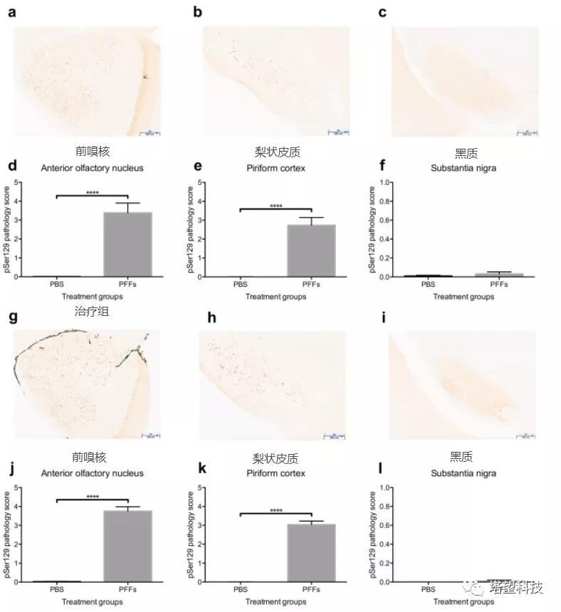 WBP全身体积描记系统在帕金森病研究中的应用