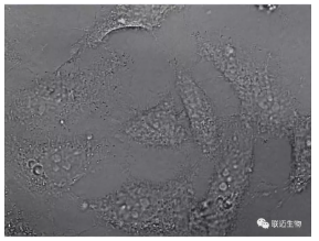 细胞铺板的这些手法,你都知道吗?