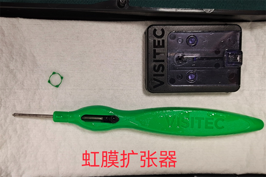 柳州市红十字会医院借助虹膜扩张器扩大瞳孔成功完成一例白内障手术