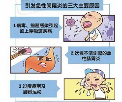 详述急性阑尾炎相关百科