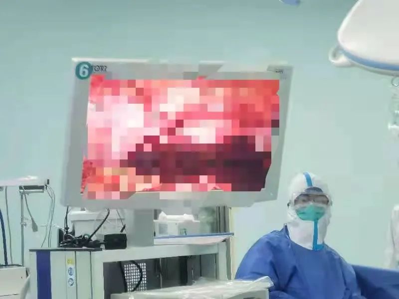 快！西安大兴医院创伤中心 5 G 速度抢救黄体破裂女子