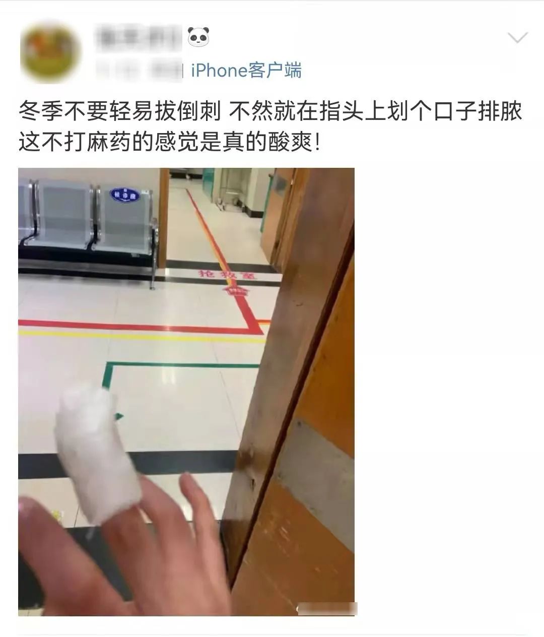 指甲旁边长倒刺,是缺维生素?