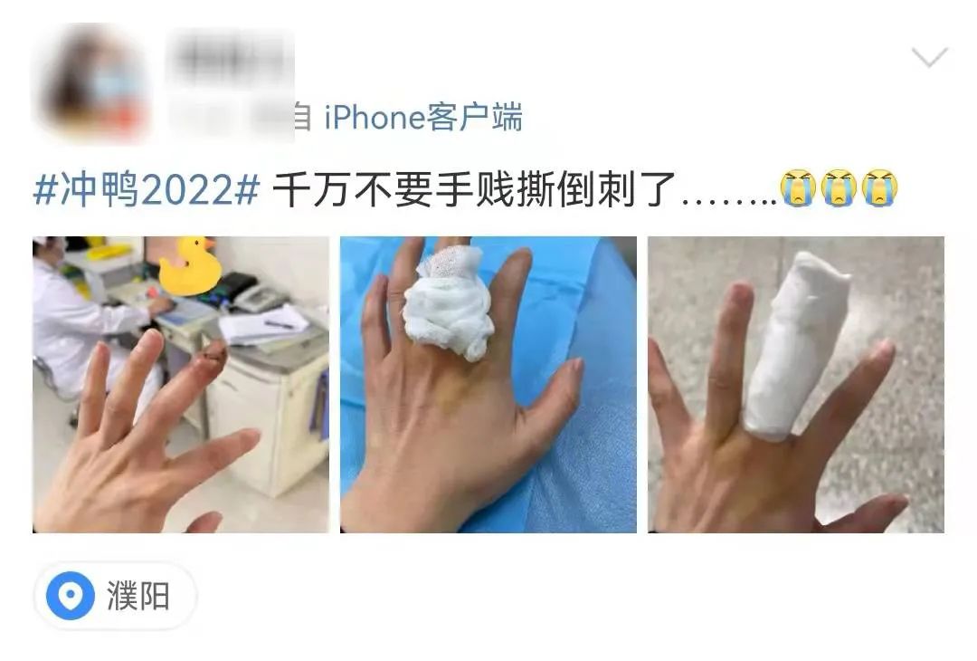 指甲旁边长倒刺,是缺维生素?