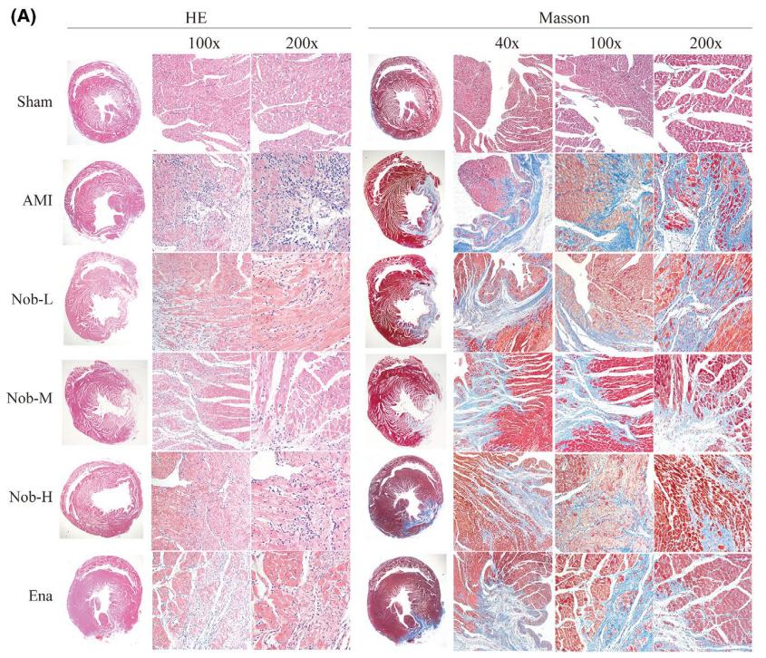 低氧/厌氧产品案例——低氧与大鼠心肌细胞OGD 研究