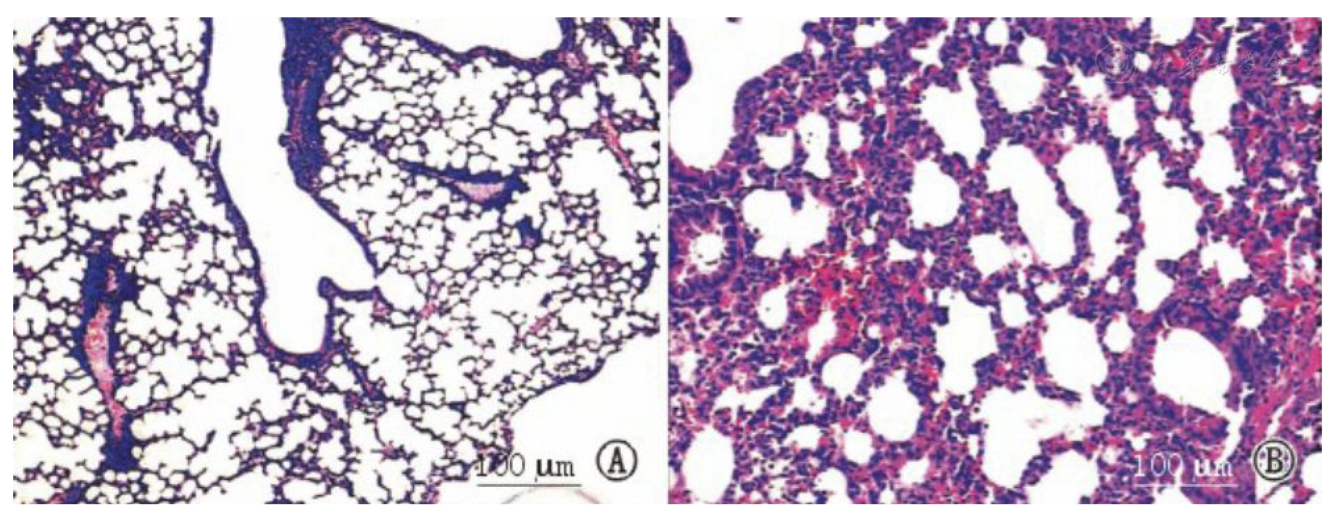 急性肺损伤（ALI）模型 / 呼吸系统模型