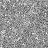 人及动物关键肿瘤细胞系现货供应