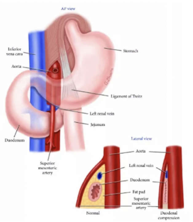 深圳 24 岁小伙「越吃越瘦」，竟是腹部动脉惹的祸