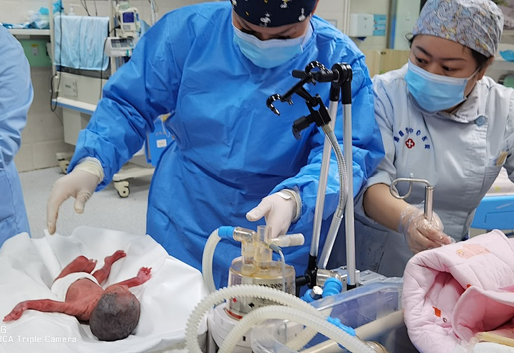 体重 950 g,28 周的早产宝宝患新生儿呼吸窘迫综合征,mist 技术助闯