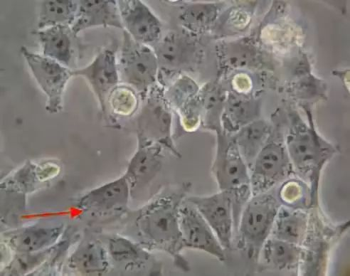 带你走近细胞生物学世界的第一步——细胞培养