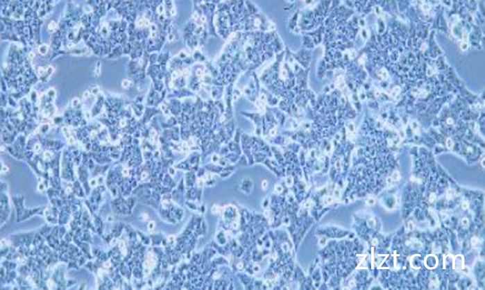 MDCK/狗肾转化细胞