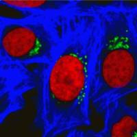 RedDot 2, 200X 40061-1