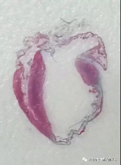 大小鼠心梗模型(MI)