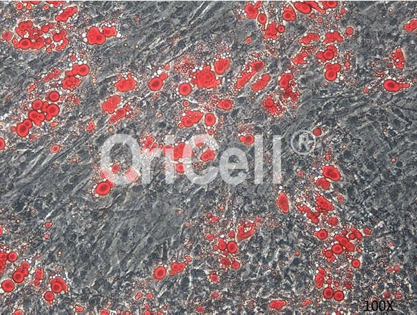 间充质干细胞的成脂诱导分化实操，我最挂心的事儿解决了