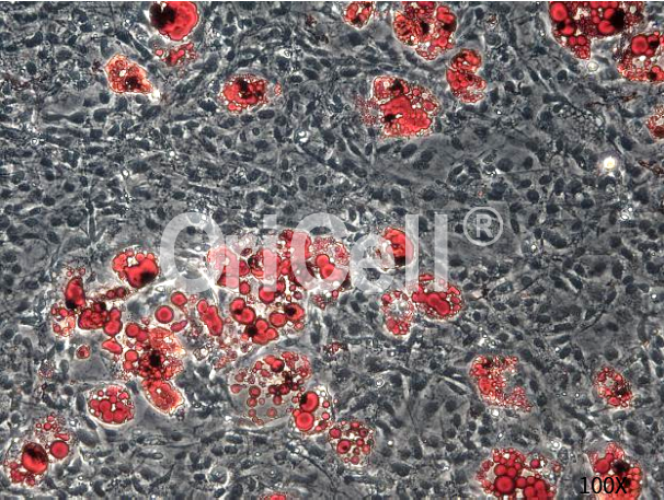 间充质干细胞的成脂诱导分化实操，我最挂心的事儿解决了