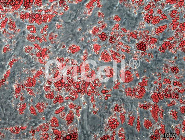 间充质干细胞的成脂诱导分化实操，我最挂心的事儿解决了