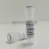 人源FTO野生型过表达慢病毒质粒