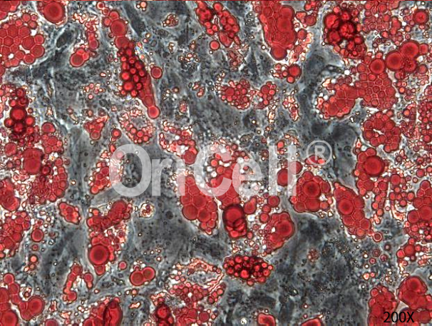 间充质干细胞的成脂诱导分化实操，我最挂心的事儿解决了