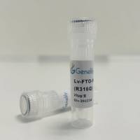 人源FTO失活型过表达慢病毒质粒