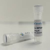 人源WTAP野生型过表达慢病毒质粒