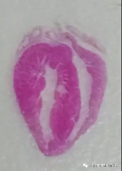 大小鼠心梗模型(MI)