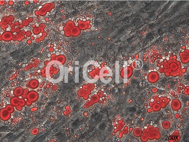 间充质干细胞的成脂诱导分化实操，我最挂心的事儿解决了