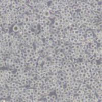 6T-CEM (人T细胞白血病细胞)带鉴定