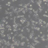 95-D [PLA-801D] (人高转移肺癌细胞)带鉴定