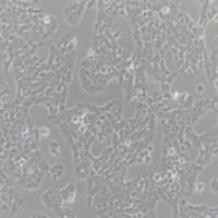 A-673 (人横纹肌肉瘤细胞)带鉴定