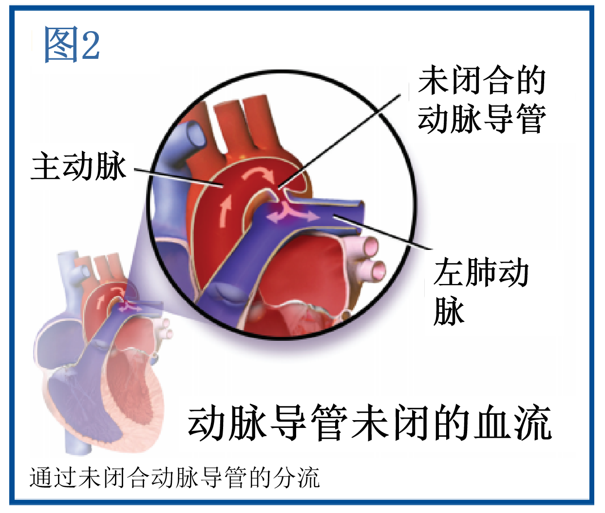 图片预览