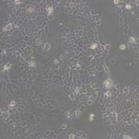 A-431 (人表皮癌细胞)带鉴定