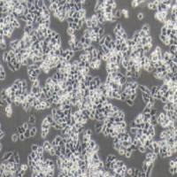 A2780 人卵巢癌细胞带鉴定