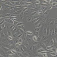 ACHN (人肾细胞腺癌细胞)带鉴定