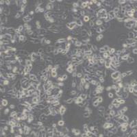 AsPC-1 (人转移胰腺腺癌细胞)带鉴定