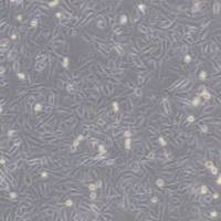 A-375 人恶性黑色素瘤细胞带鉴定