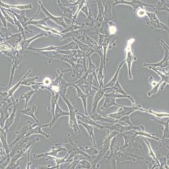 A172 (人胶质母细胞瘤细胞)带鉴定