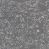 22RV1 (人前列腺癌细胞)带鉴定