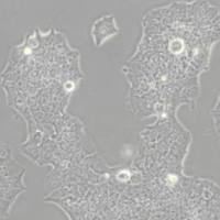 BT-474 [BT474] (人乳腺导管癌细胞)带鉴定