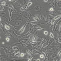 BT-549 (人乳腺管癌细胞)带鉴定