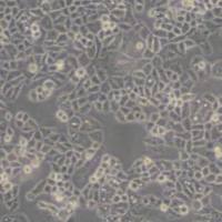 C-33 A (人子宫颈癌细胞)带鉴定