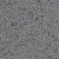 CA46 (人Burkitt's淋巴瘤细胞)带鉴定